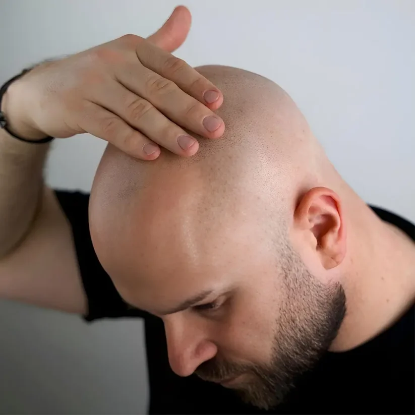 Better Be Bold Magic Bald Head &  Beard Oil 30 ml - Olej na pleš a vousy pro výživu a péči